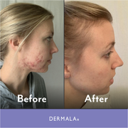 DERMALA SUPPLEMEANT to Be® Pre+Probiotic+Vitamin Skin Mix