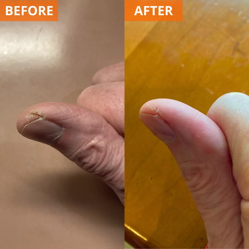 Yu-Be Moisturizing Skin Cream 4.4 Fl. Oz. Jar (Shopify Collective) Skin Moisturizer