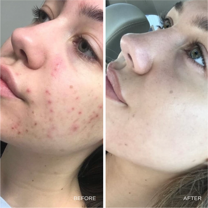 CRUDE Personal Care Oil-Cleansing Starter Kit Kit