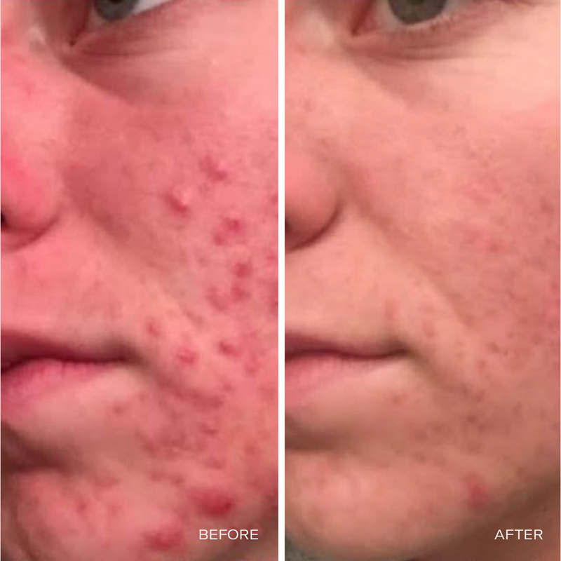 CRUDE Personal Care Bloom Serums