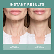 Contours Rx Neck Rescue PRODUCTS