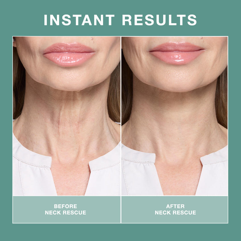 Contours Rx Neck Rescue PRODUCTS