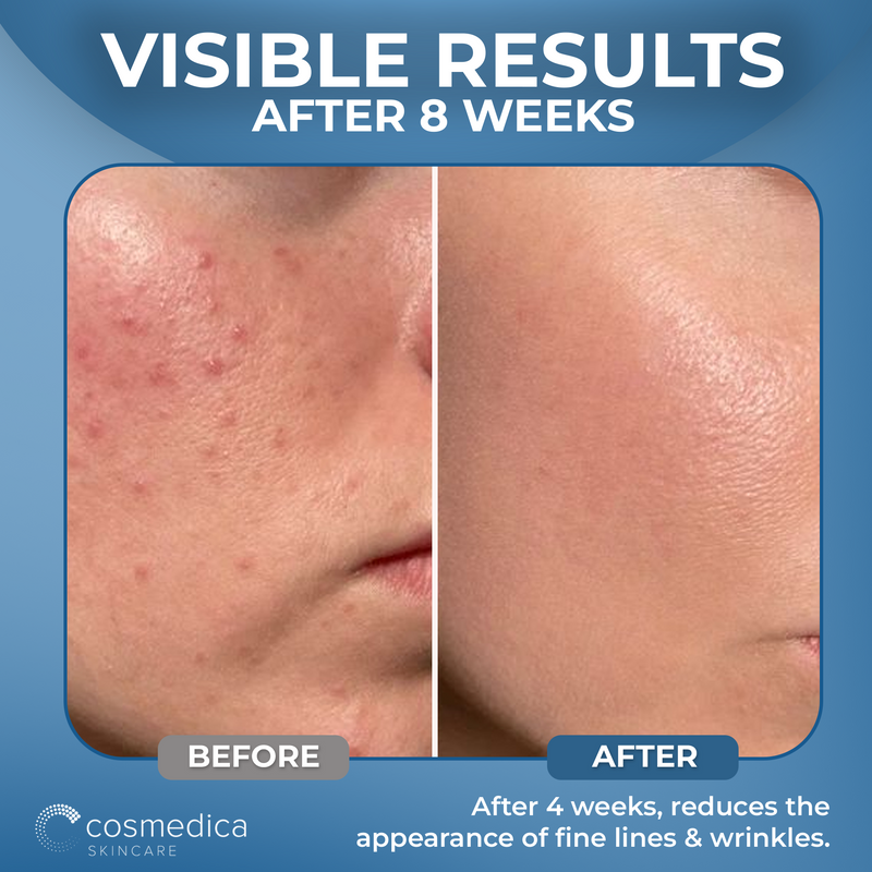 Cosmedica Skincare Hyaluronic Acid +Vitamin B5 Serum