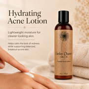 Timeless Organics Skin Care Clarifying Acne Lotion Lotion Light Gray