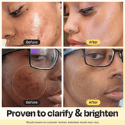 Gleamin Vitamin C Clay Mask Face Mask