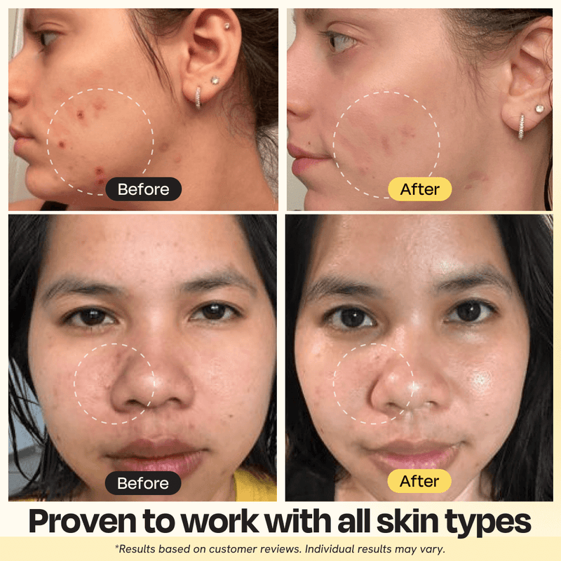 Gleamin Vitamin C Clay Mask Face Mask