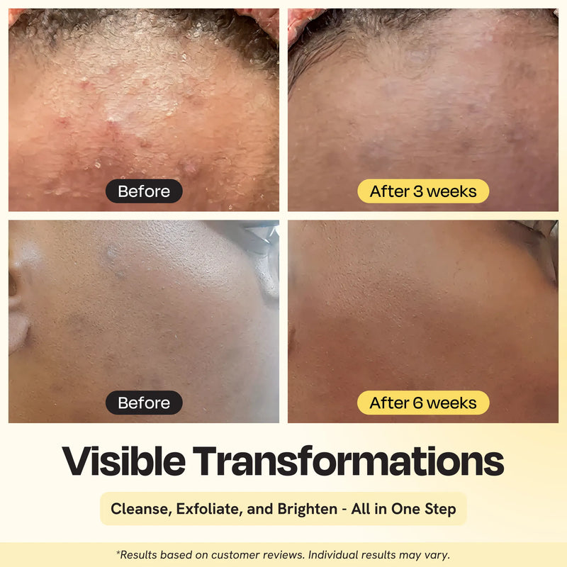Gleamin Clarifying Brightening Cleanser Facial Cleanser