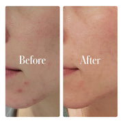 Geologie Clear System Full Routine Rosy Brown