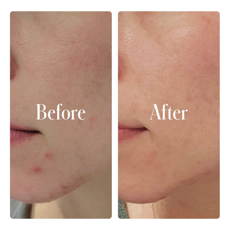 Geologie Clear System Full Routine Rosy Brown