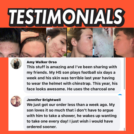 BALLBOYZ Coconut Cove Face Scrub (Medium Acne)