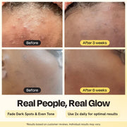 Gleamin Advanced Brightening Moisturizer Facial Moisturizer