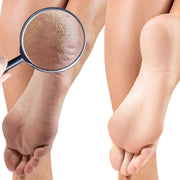 Adiva Naturals Crocodile Killer Dry Skin Pudding - Unscented (3 sizes) Moisture