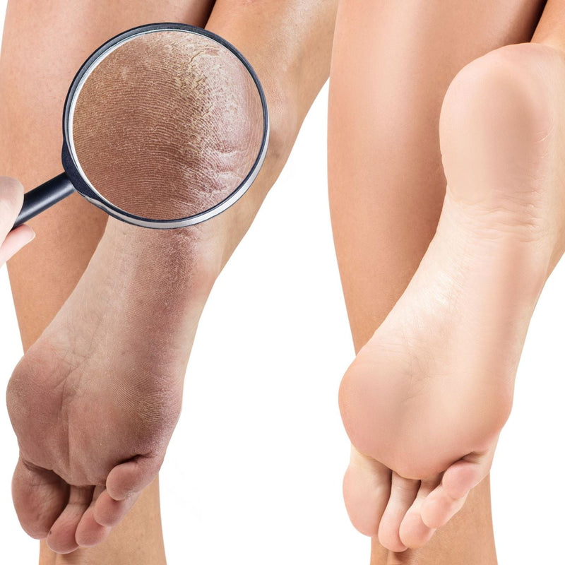 Adiva Naturals Crocodile Killer Dry Skin Pudding - Unscented (3 sizes) Moisture