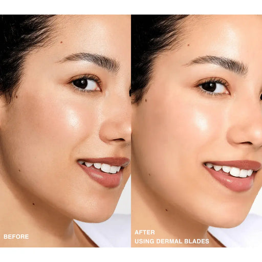 Contours Rx Dermal Blades Facial Dermaplaning Tool