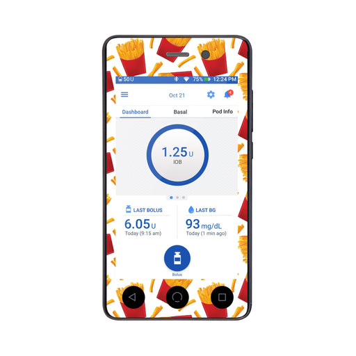 Peelz French Fries Sticker for Omnipod DASH® PDM – Pump Peelz Peelz/Stickers