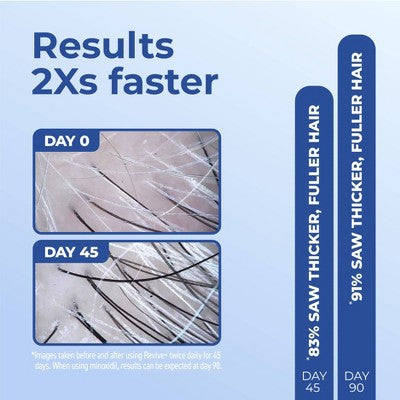 This is Beauty US BosleyMD Revive + Densifying Hair Regrowth Serum for Men 1 fl oz - Imperfect Box HEALTH AND BEAUTY