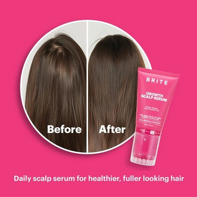 This is Beauty US BRITE Growth Scalp Serum with Applicator 3.38 fl oz - Imperfect Box HEALTH AND BEAUTY