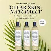 Glimmer Goddess® Organic Skin Care Organic Acne Cleanser – Gentle Face & Body Wash Facial Cleanser