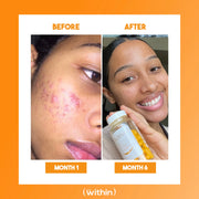 Clear Within Clear Skin Vitamin