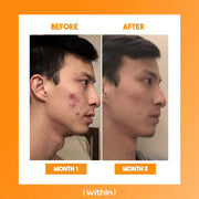 Clear Within Clear Skin Vitamin