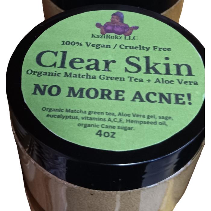 Organic Matcha Green Tea + Aloe Vera Acne Treatment/ Clear Skin Treatment (100% Vegan/CrueltyFree) 4oz