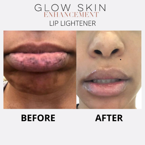 Glow Skin Enhancement LIP LIGHTENER Lip Care