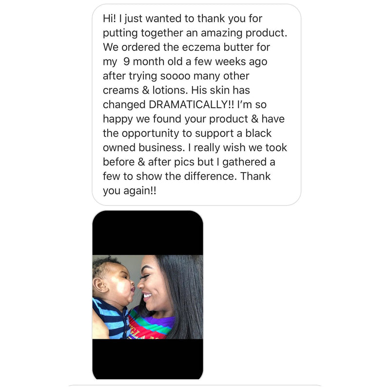 Lizzie's All-natural Products Lizzies All Natural Eczema Butter