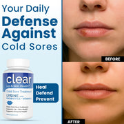 Clear Wellness 360 Lysine + Probiotic Supplement for Cold Sore Support | Lip & Skin Health + Immune Support Probiotics Plus