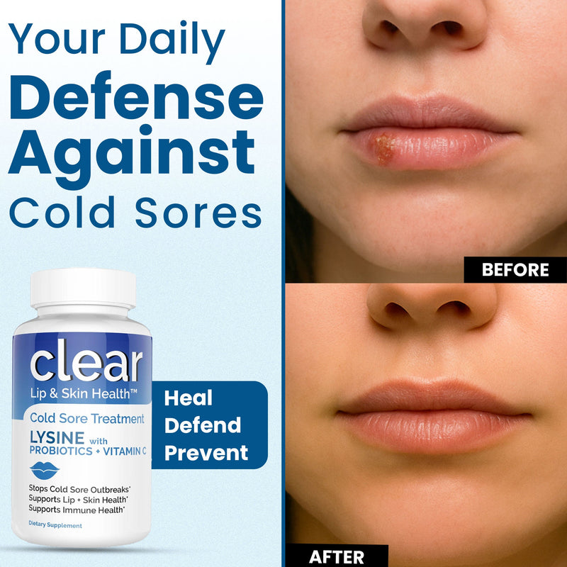 Clear Wellness 360 Lysine + Probiotic Supplement for Cold Sore Support | Lip & Skin Health + Immune Support Probiotics Plus