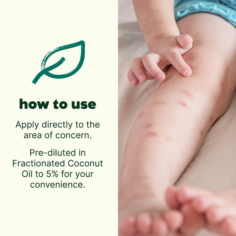 Plant Therapy Itch Away Essential Oil Pre-Diluted Roll-On Essential Oil Seashell 10 mL