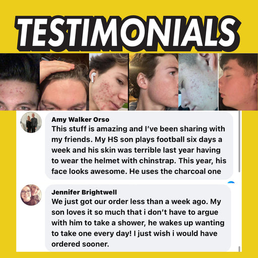 BALLBOYZ Lemonade Face Scrub (Light Acne)