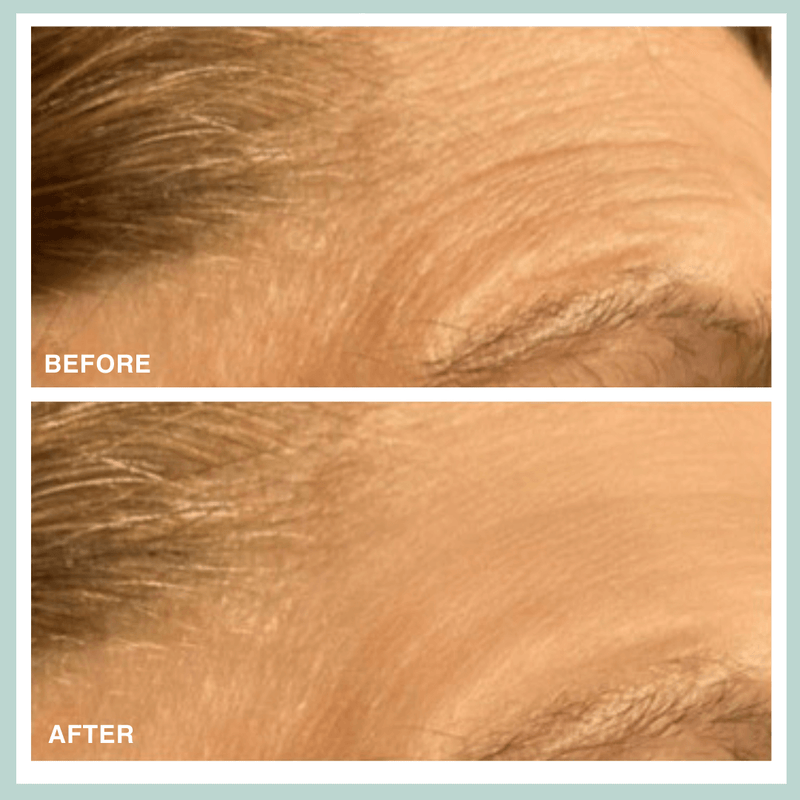 Contours Rx Microcrystal Patch Anti-Aging Eye Patches