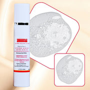 gymsegbë Thick As Thieves Pure Glycolic Acid Lactic Acid Extreme Gel Peel - 50ml Exfoliation, Dark Spots, Hyperpigmentation