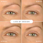 Contours Rx Lids By Design Assortment Pack PRODUCTS