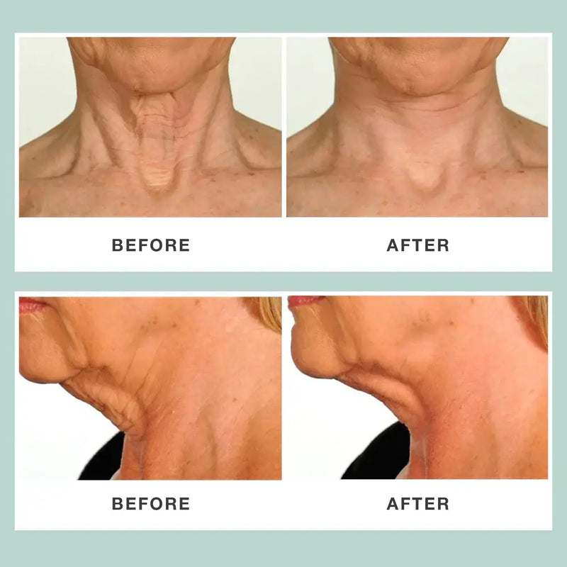 Contours Rx Neck Rescue PRODUCTS