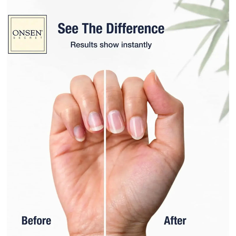 Onsen Secret Complete Nail Reboot Kit Nail Kit