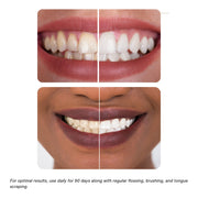 KÖPPEN Daily Oil Mouthwash | Healthy Teeth & Gums Oral Care