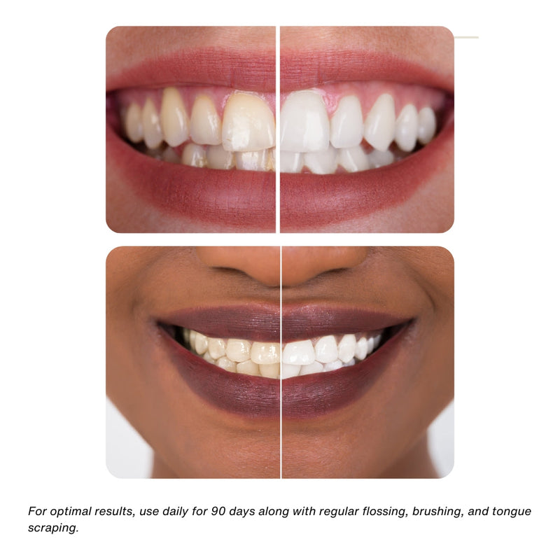 KÖPPEN Daily Oil Mouthwash | Healthy Teeth & Gums Oral Care