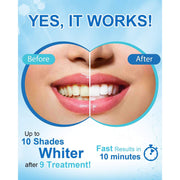 MySmile MySmile Teeth Whitening Pen w/ 35%CP Teeth Whitening