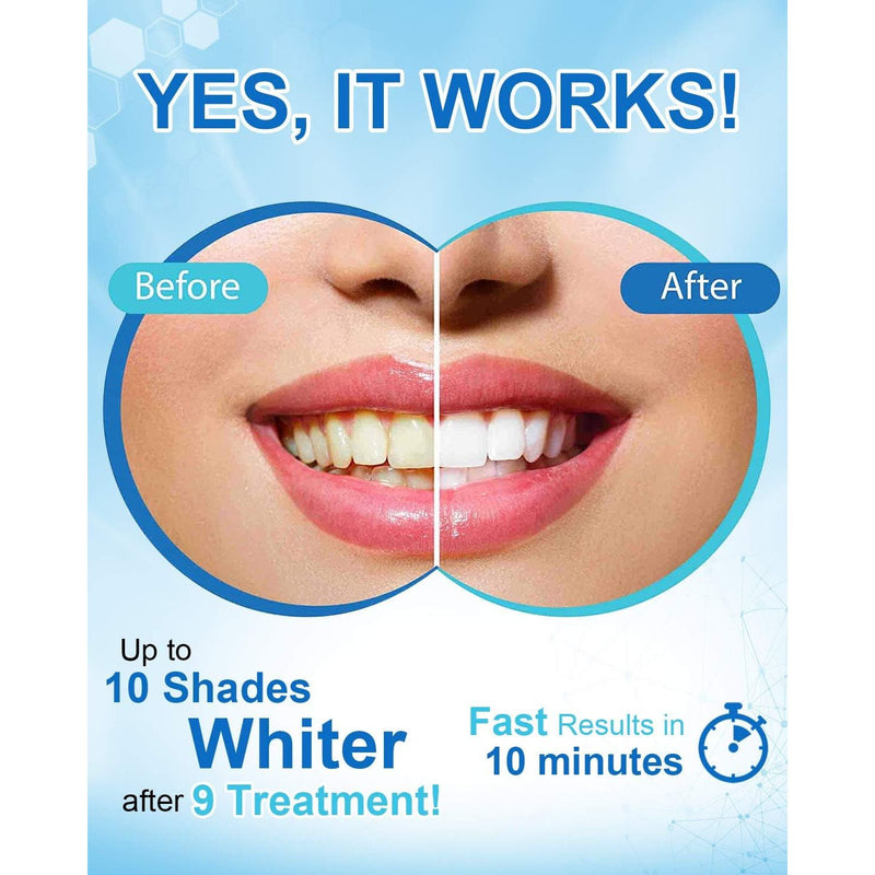 MySmile MySmile Teeth Whitening Pen w/ 35%CP Teeth Whitening