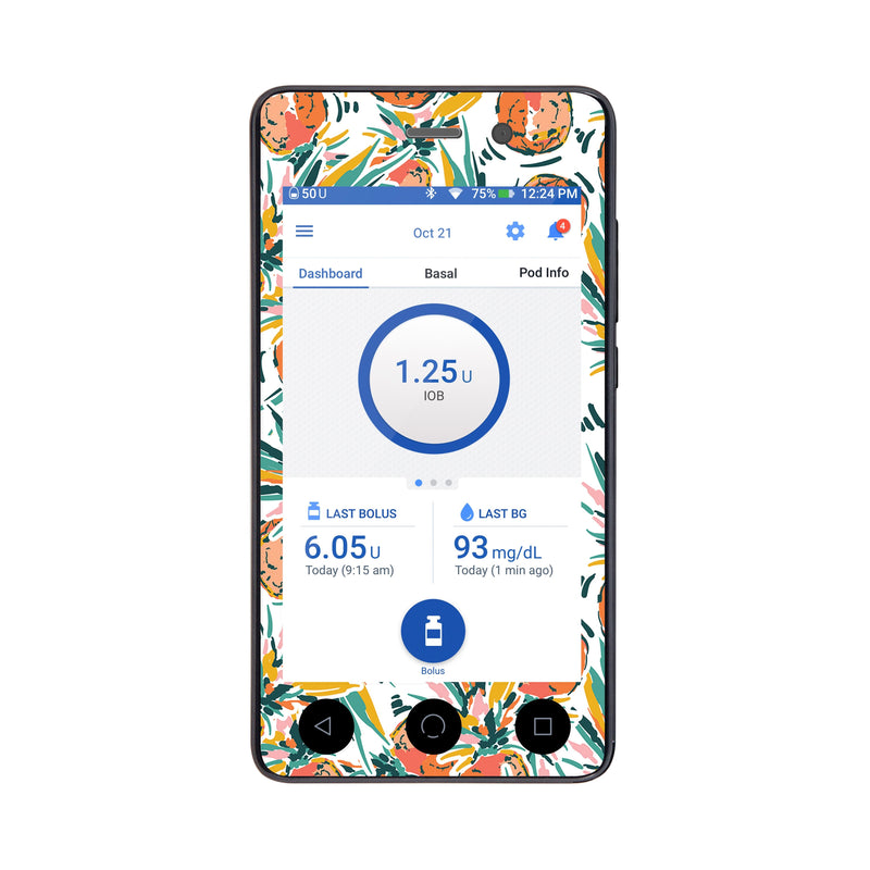 Peelz Pineapple Paradise Sticker for Omnipod DASH® PDM – Pump Peelz Peelz/Stickers