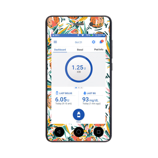 Peelz Pineapple Paradise Sticker for Omnipod DASH® PDM – Pump Peelz Peelz/Stickers
