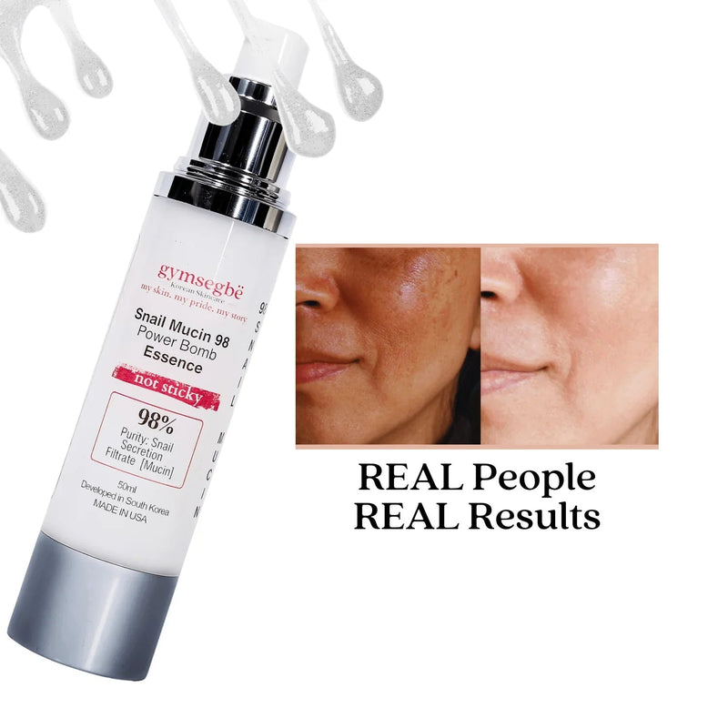 gymsegbë Snail Mucin 98 Power Bomb Essence Anti-Aging Facial White Smoke 1 Bottle,2 Bottles Save $0.99,3 Bottles Save $2.98,4 Bottles Save $4.97