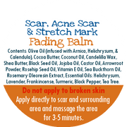 By Robin Creations Scar Fading Balm & Acne Healing Oil Set for Face & Body Skin Care White Smoke 2oz Tin + Roll-on,4oz Tin + Roll-on,8oz Glass Jar + Roll-on