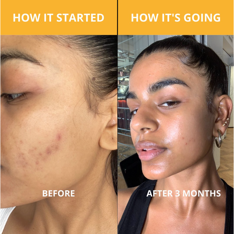 TUMERI Turmeric Kojic Acid Soap - Face and Body Health & Beauty