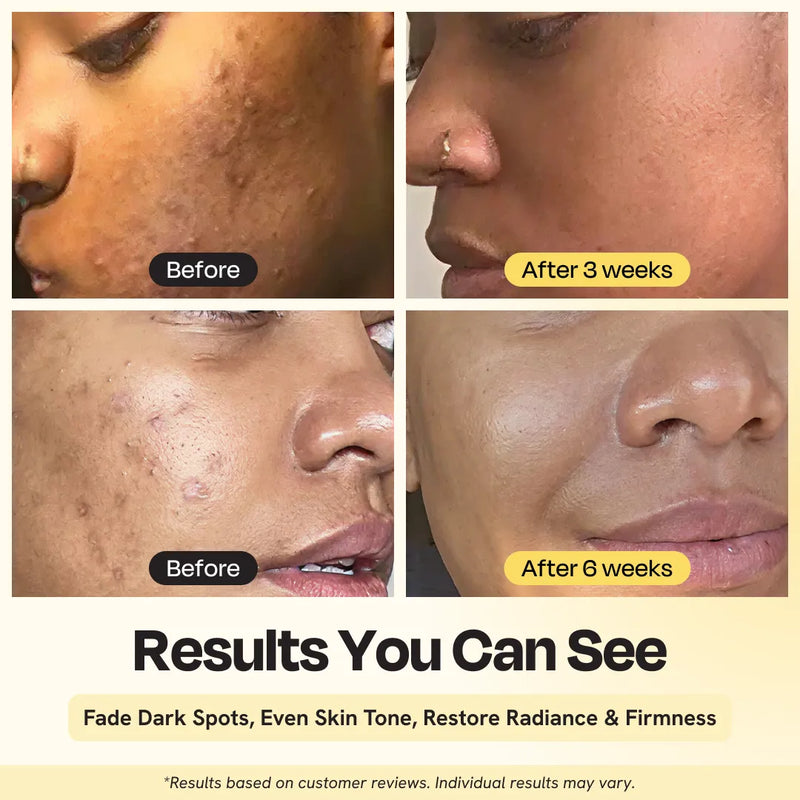 Gleamin Superactive Serum Face Serum