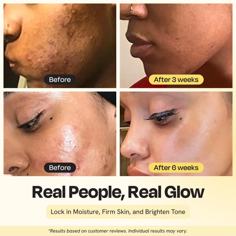 Gleamin Supernutrient Oil Face Oil