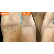 Yu-Be Moisturizing Skin Cream (Shopify Collective) Skin Moisturizer