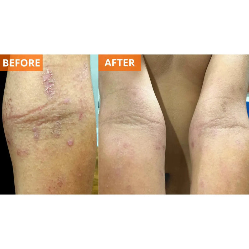 Yu-Be Moisturizing Skin Cream (Shopify Collective) Skin Moisturizer