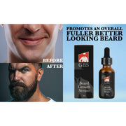 Mill's Beauty Supply G.B.S Beard Natural Hair Growth Serum with Biotin 1 oz Beard Oil